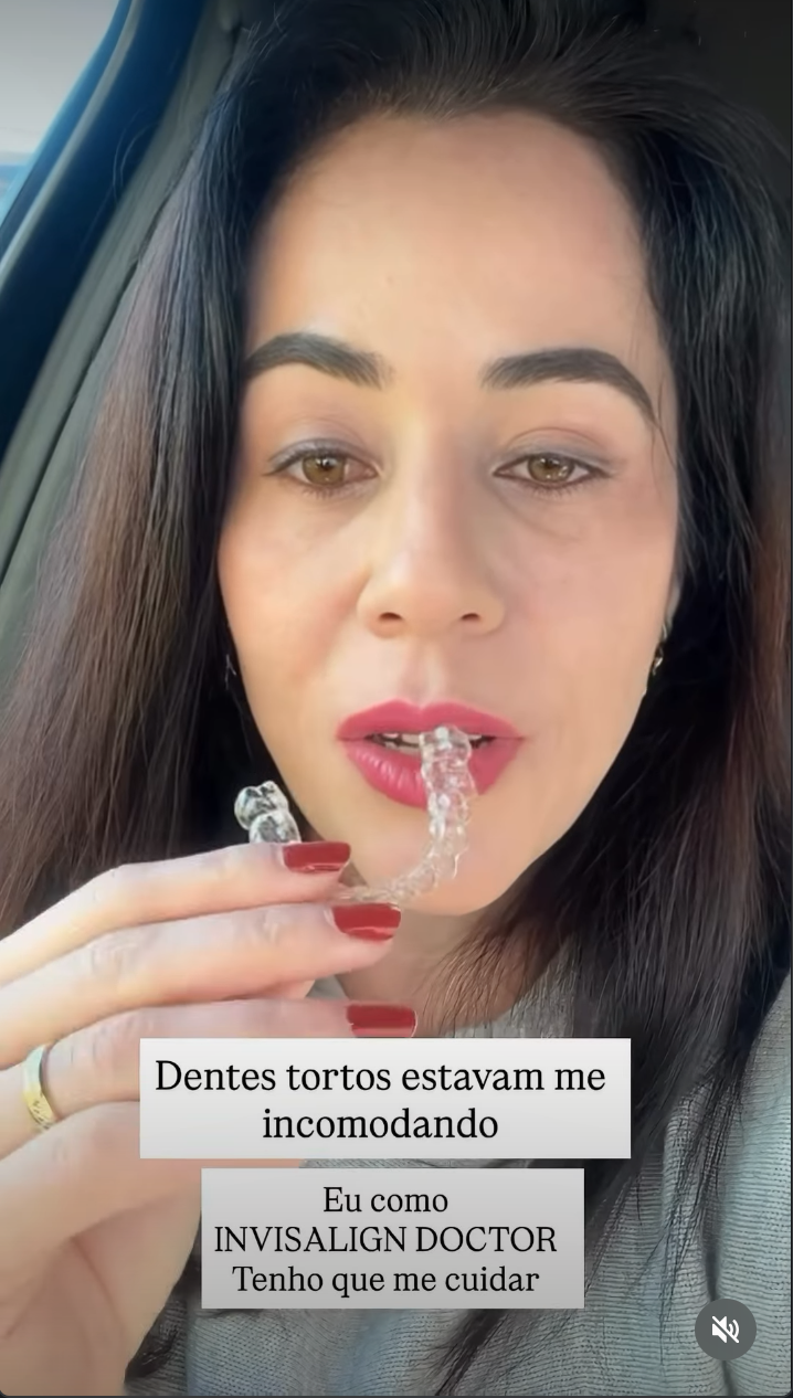 Reels de Invisalign com 2,1 mi de visualizações